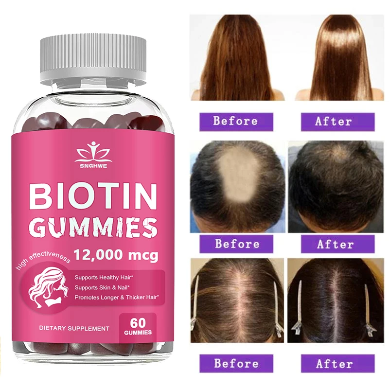 Collagen & Biotin Gummies for Hair, Skin, and Nail Health